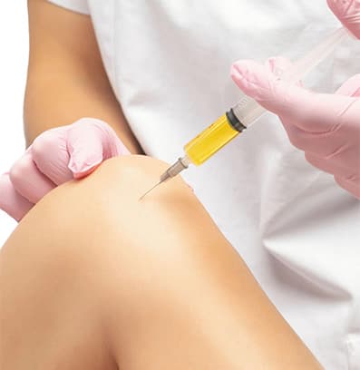 PRP Therapy process illustration