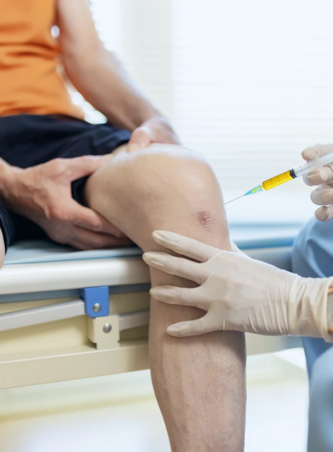 Prp therapy